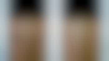 Cursus Slow run of Slow to Go 2 gratis proeflessen