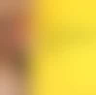 Alzheimer café Hilversum