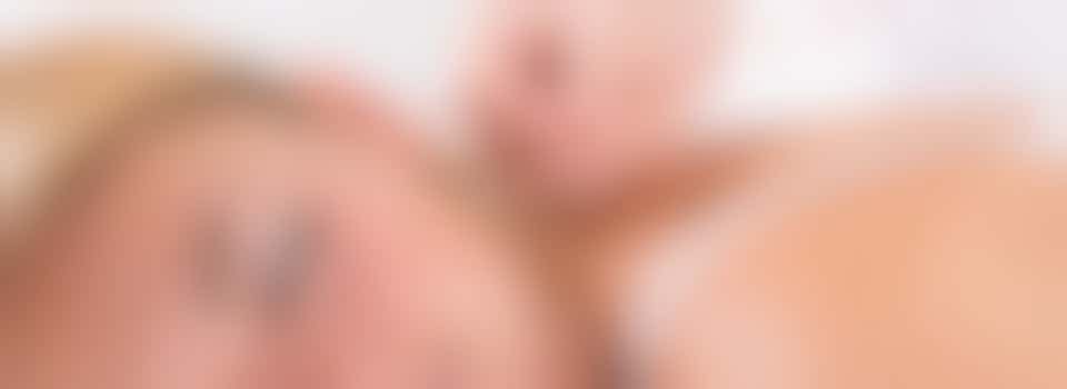 Acupuncture therapist volunteer