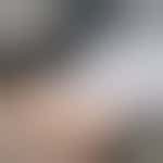 Scar Therapist Volunteer - St Albans or Watford